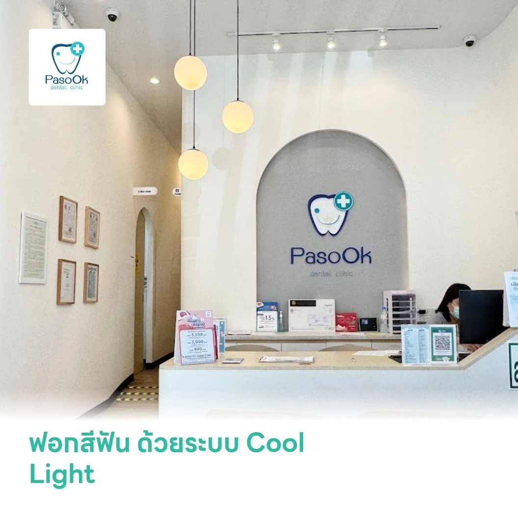 ฟอกสีฟัน ด้วยระบบ Cool Light