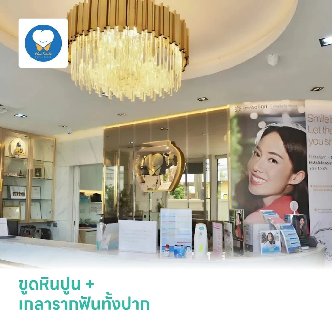 ขูดหินปูน + เกลารากฟันทั้งปาก