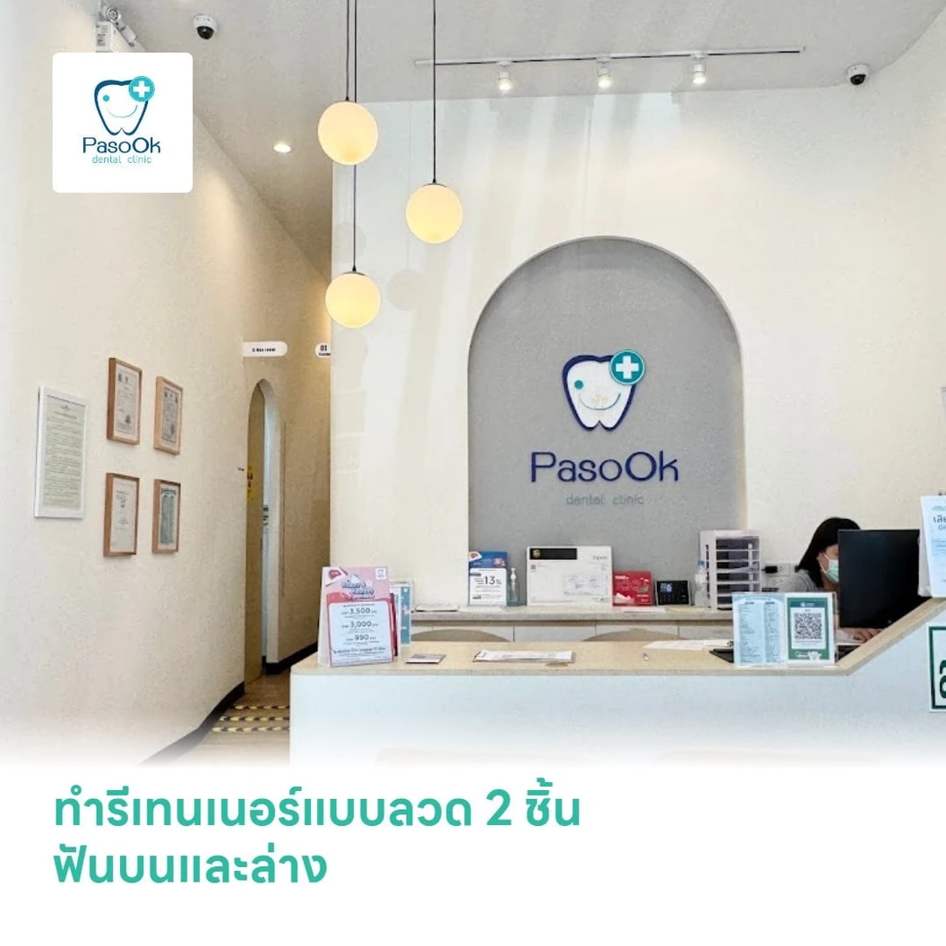 ทำรีเทนเนอร์แบบลวด 2 ชิ้น ฟันบนและล่าง