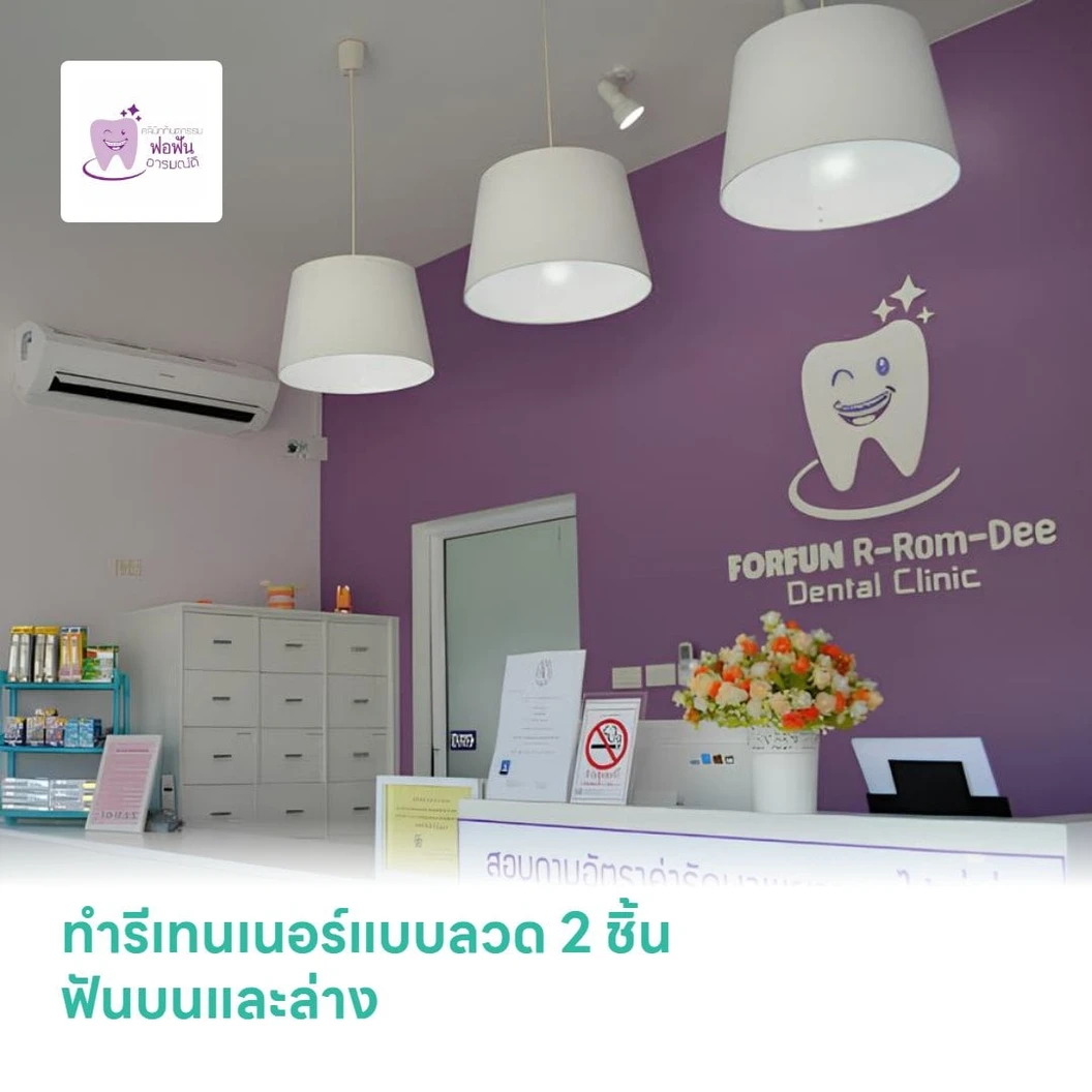 ทำรีเทนเนอร์แบบลวด 2 ชิ้น ฟันบนและล่าง