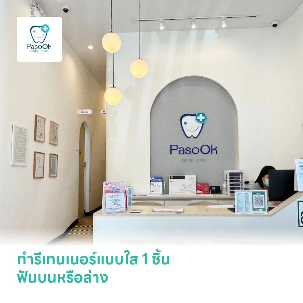 ทำรีเทนเนอร์แบบใส 1 ชิ้น ฟันบนหรือล่าง