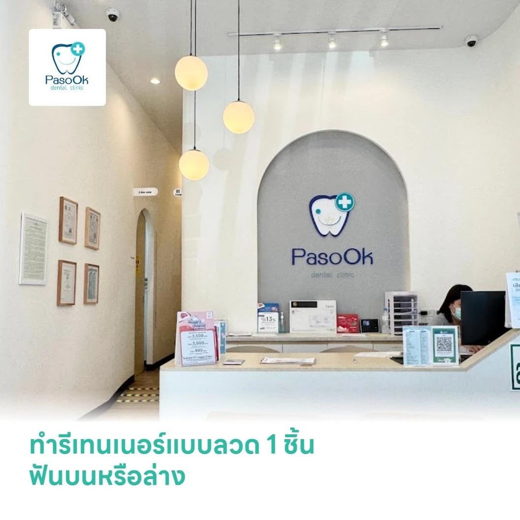 ทำรีเทนเนอร์แบบลวด 1 ชิ้น ฟันบนหรือล่าง