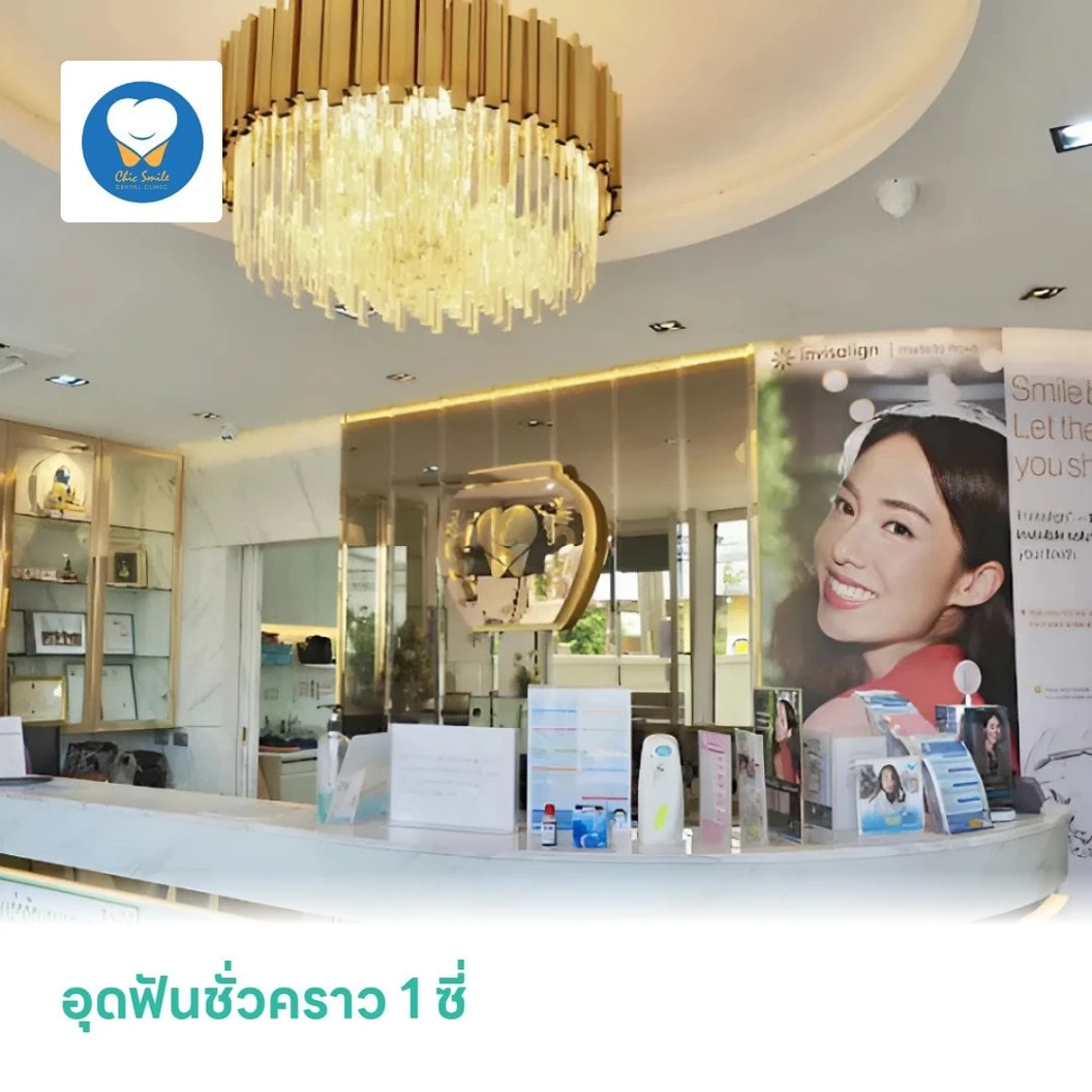 อุดฟันชั่วคราว 1 ซี่