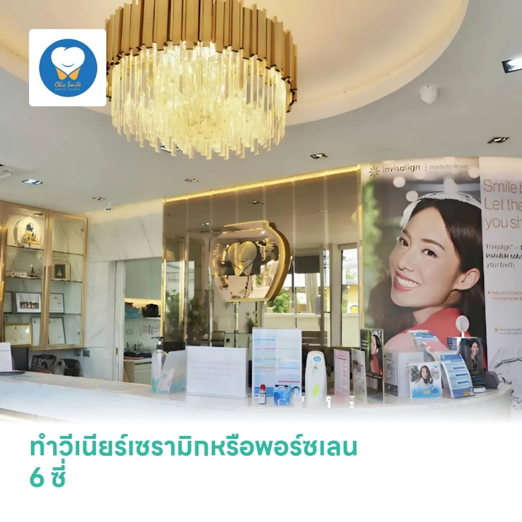ทำวีเนียร์เซรามิกหรือพอร์ซเลน 6 ซี่