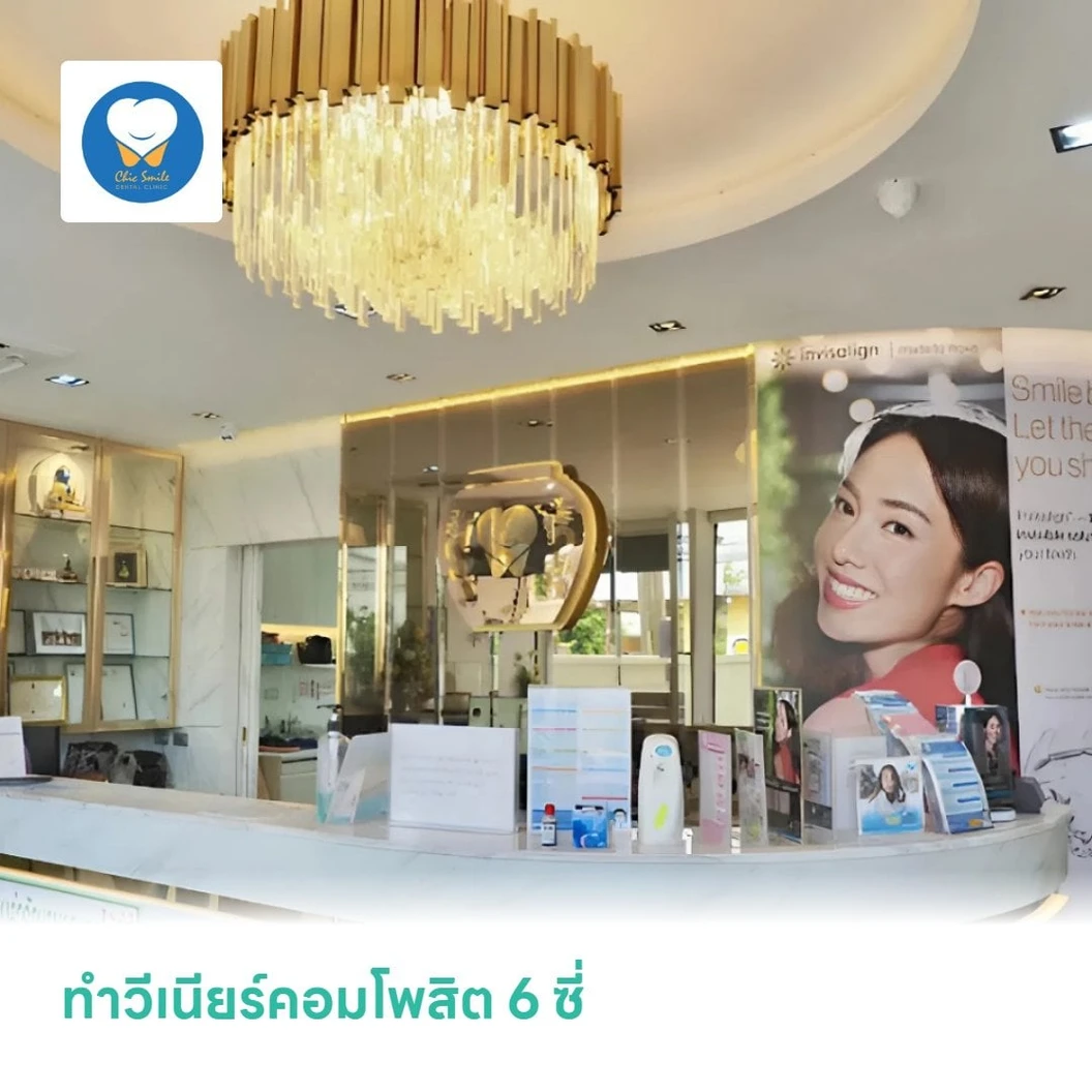 ทำวีเนียร์คอมโพสิต 6 ซี่