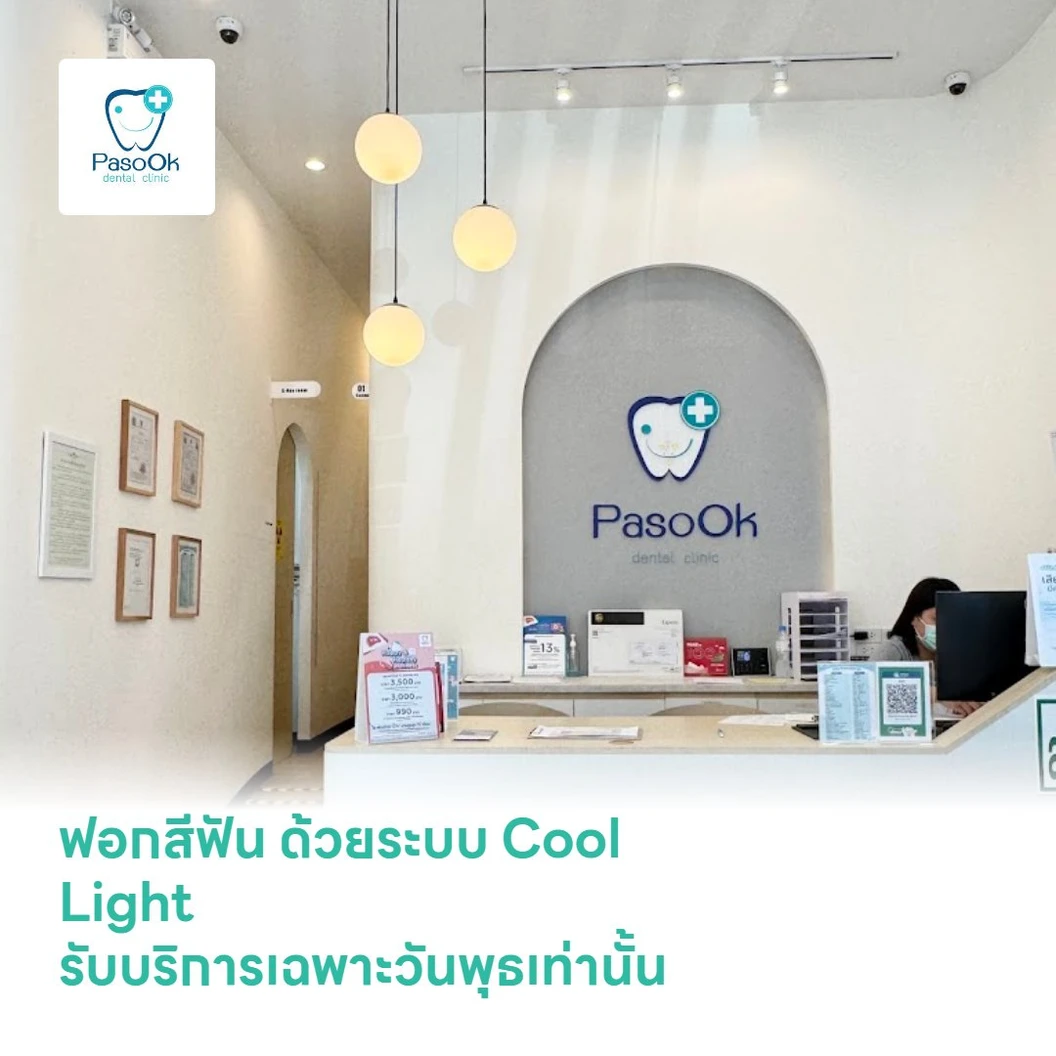 ฟอกสีฟัน ด้วยระบบ Cool Light รับบริการเฉพาะวันพุธเท่านั้น