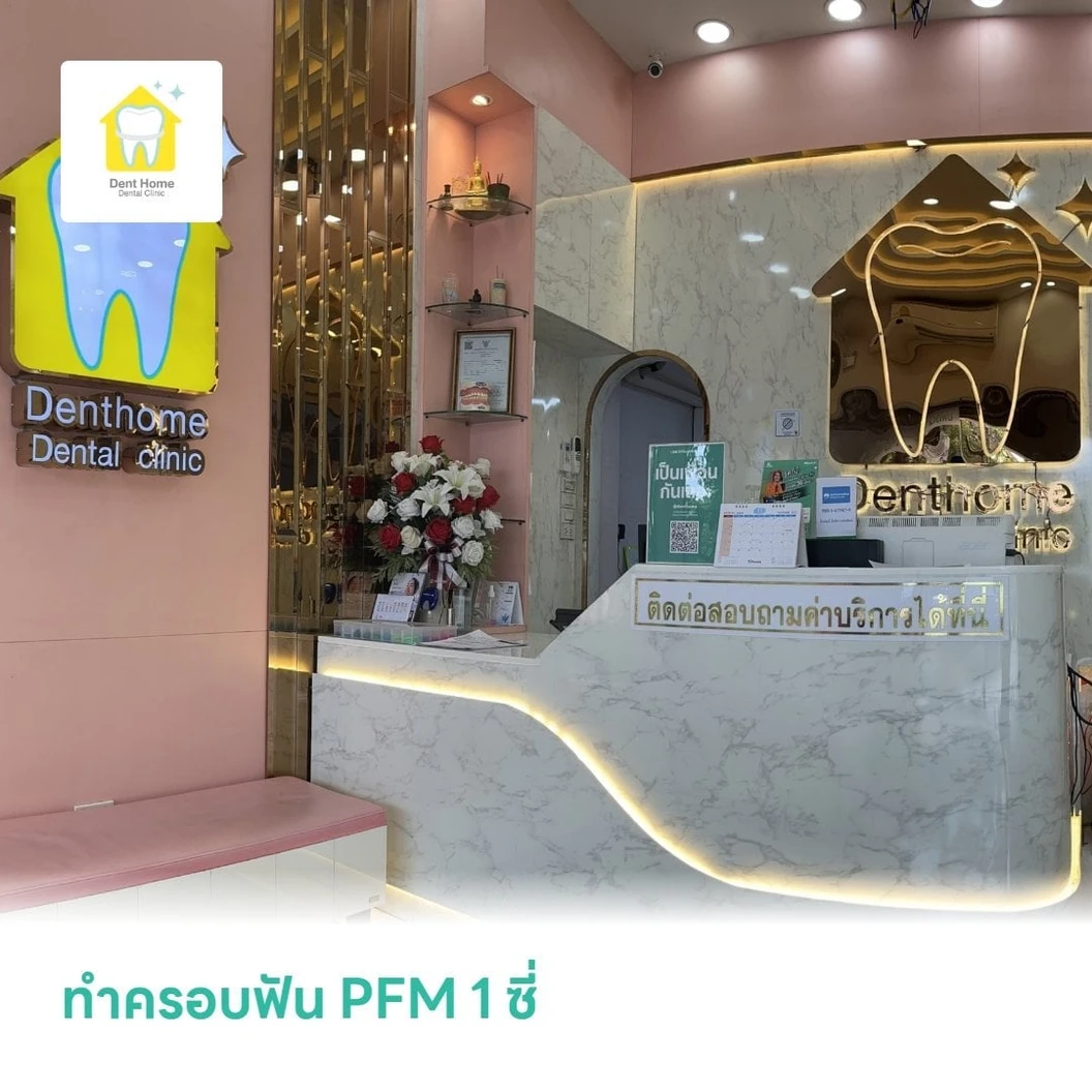 ทำครอบฟัน PFM 1 ซี่