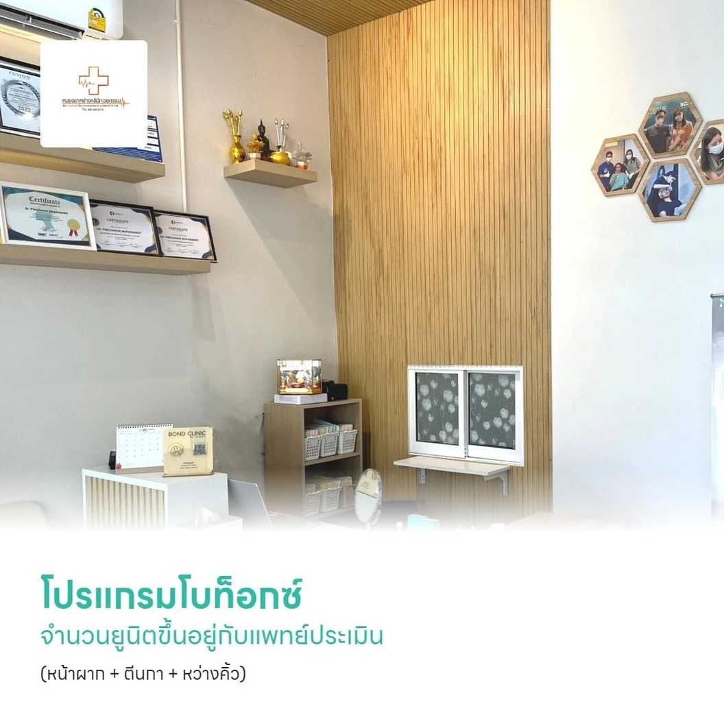 โปรแกรมโบท็อกซ์ จำนวนยูนิตขึ้นอยู่กับแพทย์ประเมิน (หน้าผาก + ตีนกา + หว่างคิ้ว)