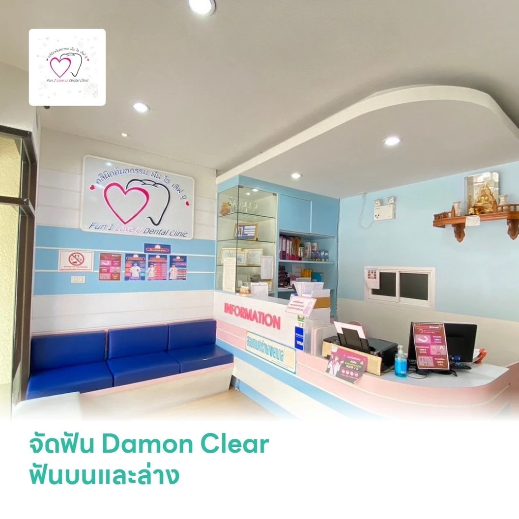 จัดฟัน Damon Clear ฟันบนและล่าง