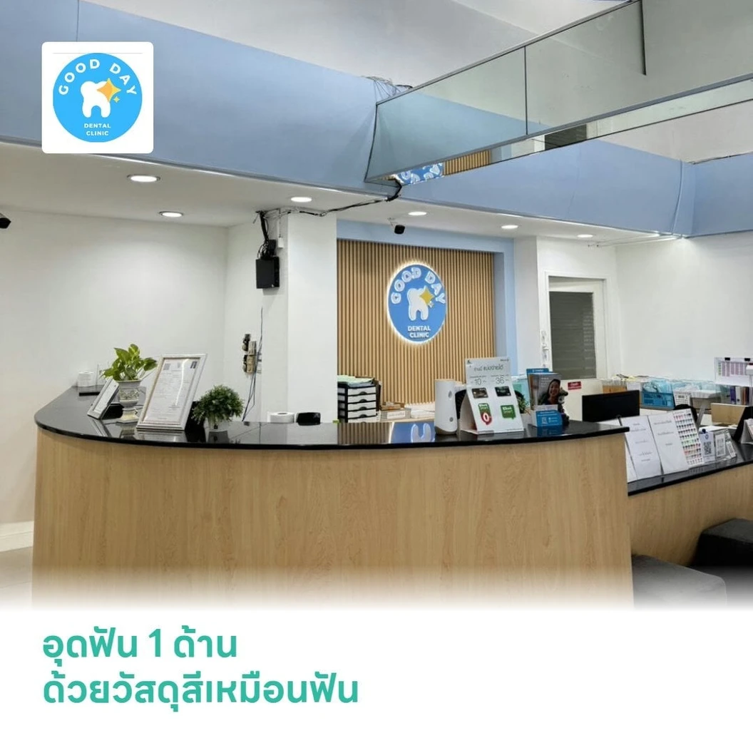 อุดฟัน 1 ด้าน ด้วยวัสดุสีเหมือนฟัน