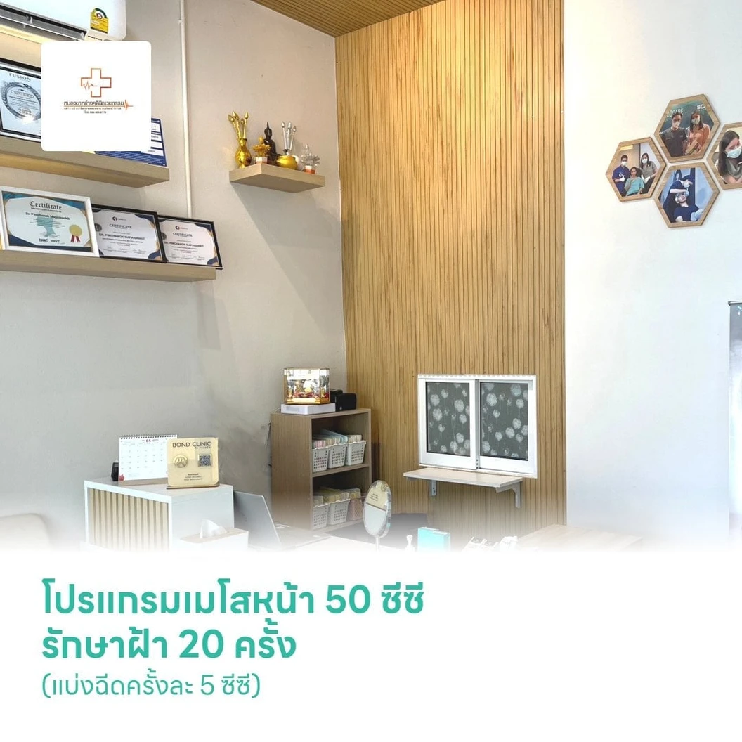โปรแกรมเมโสหน้า 50 ซีซี รักษาฝ้า 20 ครั้ง (แบ่งฉีดครั้งละ 5 ซีซี)