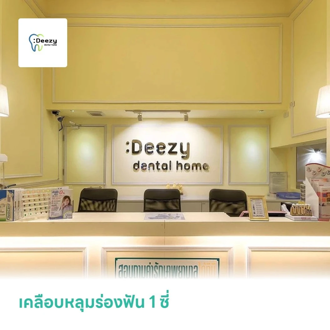 เคลือบหลุมร่องฟัน 1 ซี่