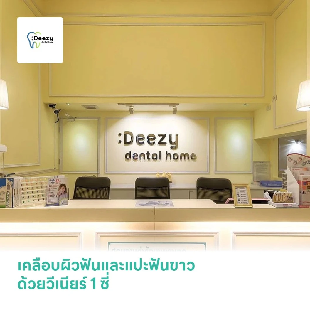 เคลือบผิวฟันและแปะฟันขาว ด้วยวีเนียร์ 1 ซี่
