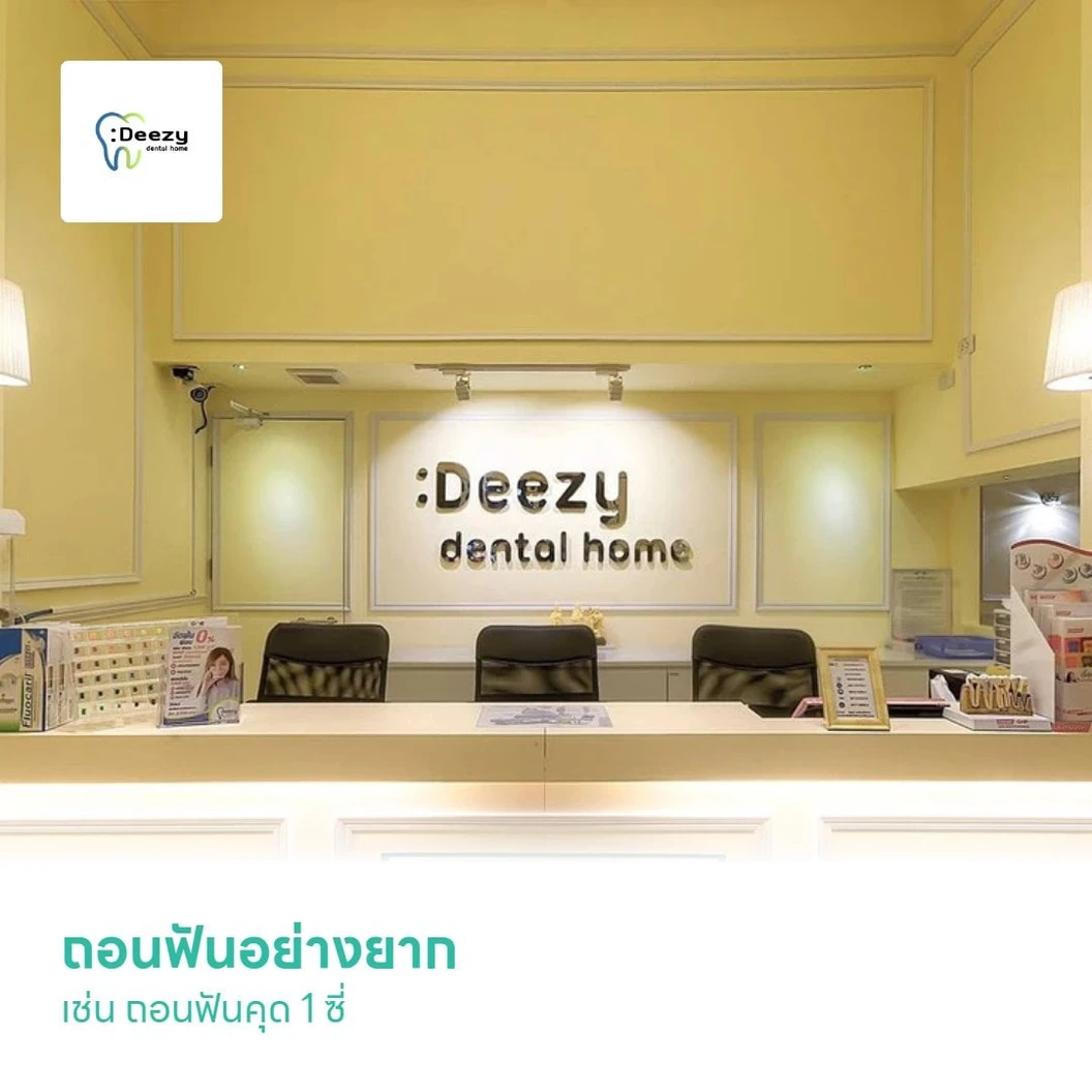 ถอนฟันอย่างยาก เช่น ถอนฟันคุด 1 ซี่