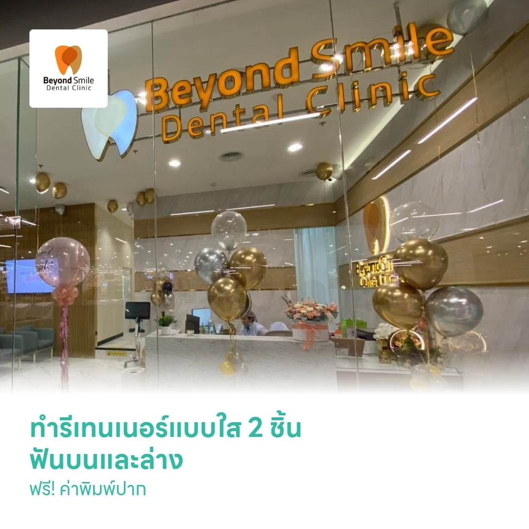 ทำรีเทนเนอร์แบบใส 2 ชิ้น ฟันบนและล่าง ฟรี! ค่าพิมพ์ปาก