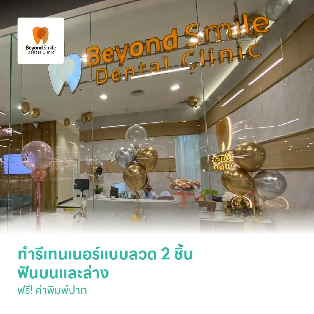 ทำรีเทนเนอร์แบบลวด 2 ชิ้น ฟันบนและล่าง ฟรี! ค่าพิมพ์ปาก