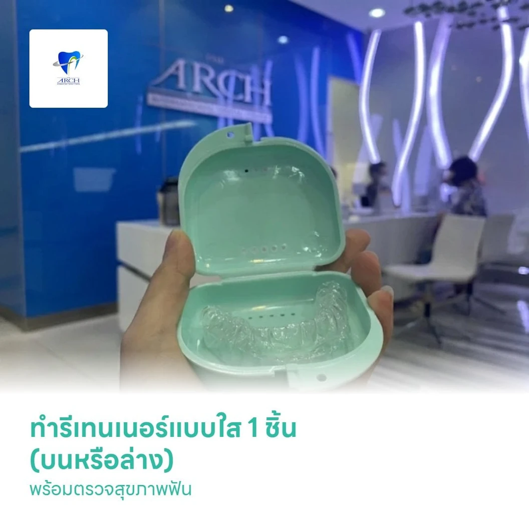 ทำรีเทนเนอร์แบบใส 1 ชิ้น (บนหรือล่าง) พร้อมตรวจสุขภาพฟัน