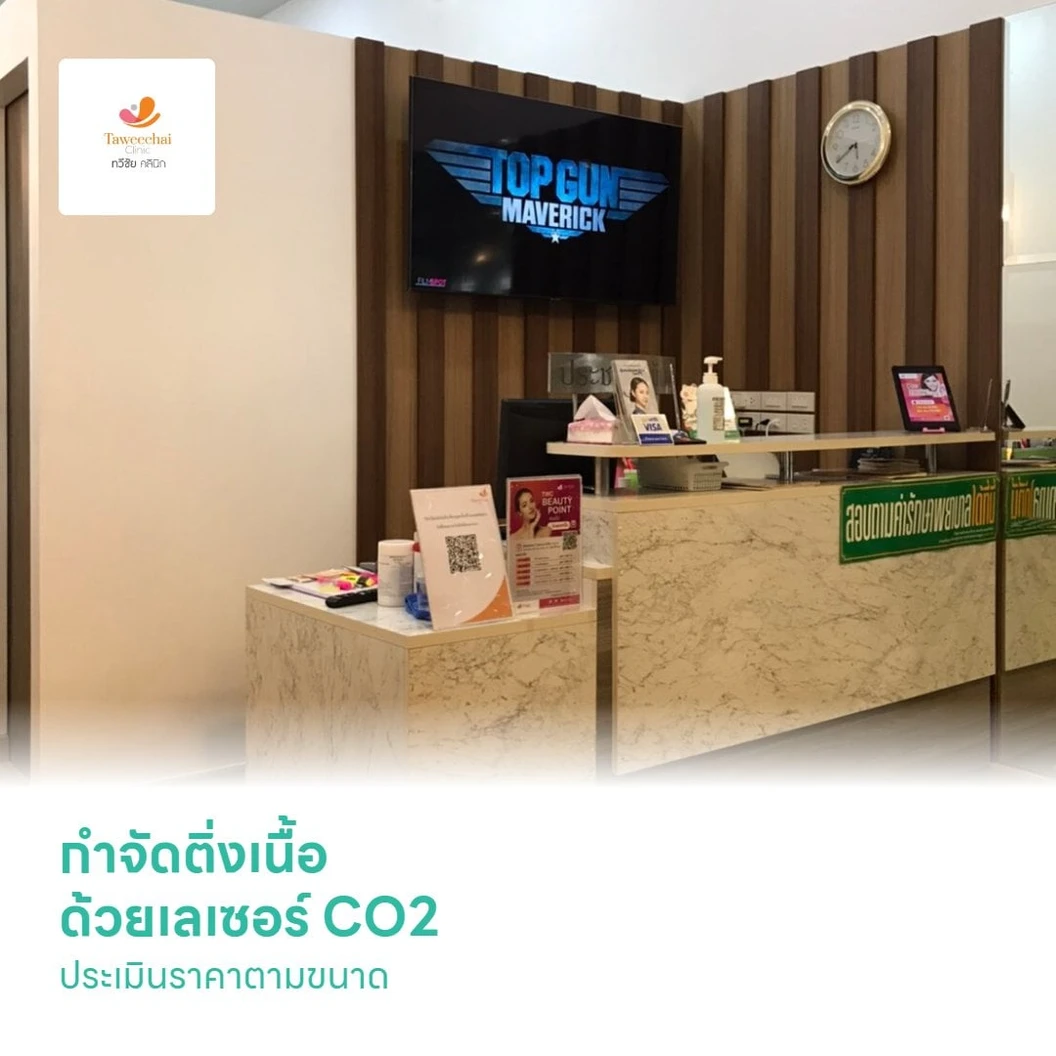 กำจัดติ่งเนื้อ ด้วยเลเซอร์ CO2 1 ครั้ง ประเมินราคาตามขนาด