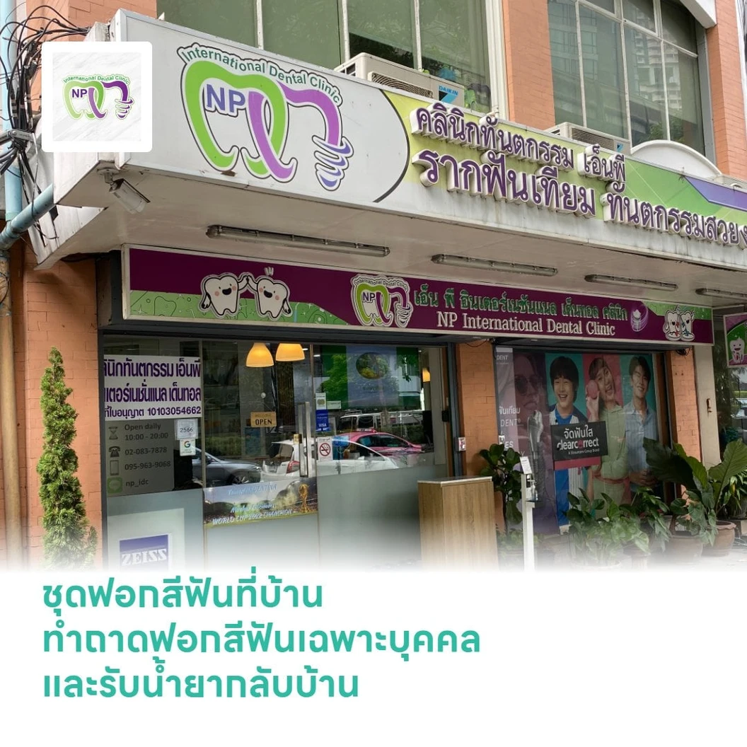 ชุดฟอกสีฟันที่บ้าน ทำถาดฟอกสีฟันเฉพาะบุคคลและรับน้ำยากลับบ้าน