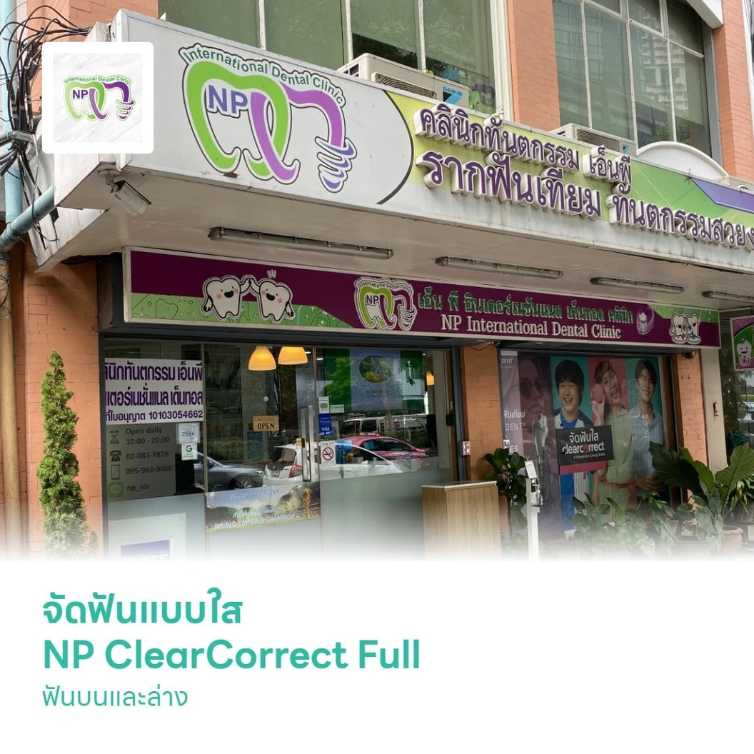 จัดฟันแบบใส NP ClearCorrect Full ฟันบนและล่าง แก้ไขทุกปัญหาการจัดฟัน