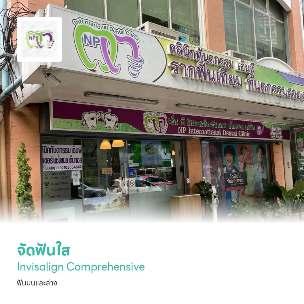 จัดฟันแบบใส Invisalign Comprehensive ฟันบนและล่าง