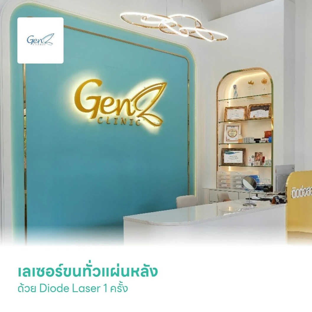 เลเซอร์ขนทั่วแผ่นหลัง ด้วย Diode Laser 1 ครั้ง สำหรับผู้หญิงหรือผู้ชาย