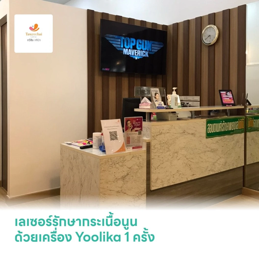 เลเซอร์รักษากระเนื้อนูน ด้วยเครื่อง Yoolika 1 จุด 1 ครั้ง