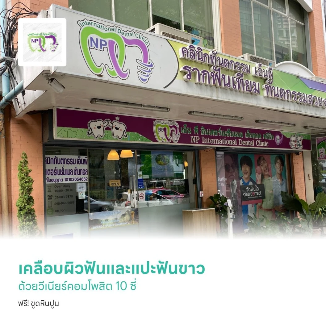 เคลือบผิวฟันและแปะฟันขาว ด้วยวีเนียร์คอมโพสิต 10 ซี่ ฟรี! ขูดหินปูน ด้วยเครื่อง Piezo 1 ครั้ง