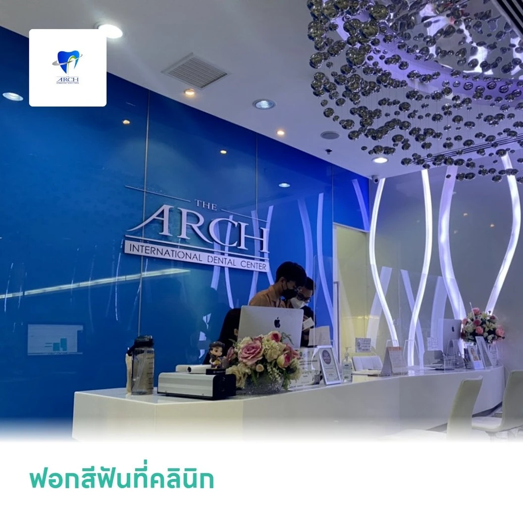 ฟอกสีฟันที่คลินิก