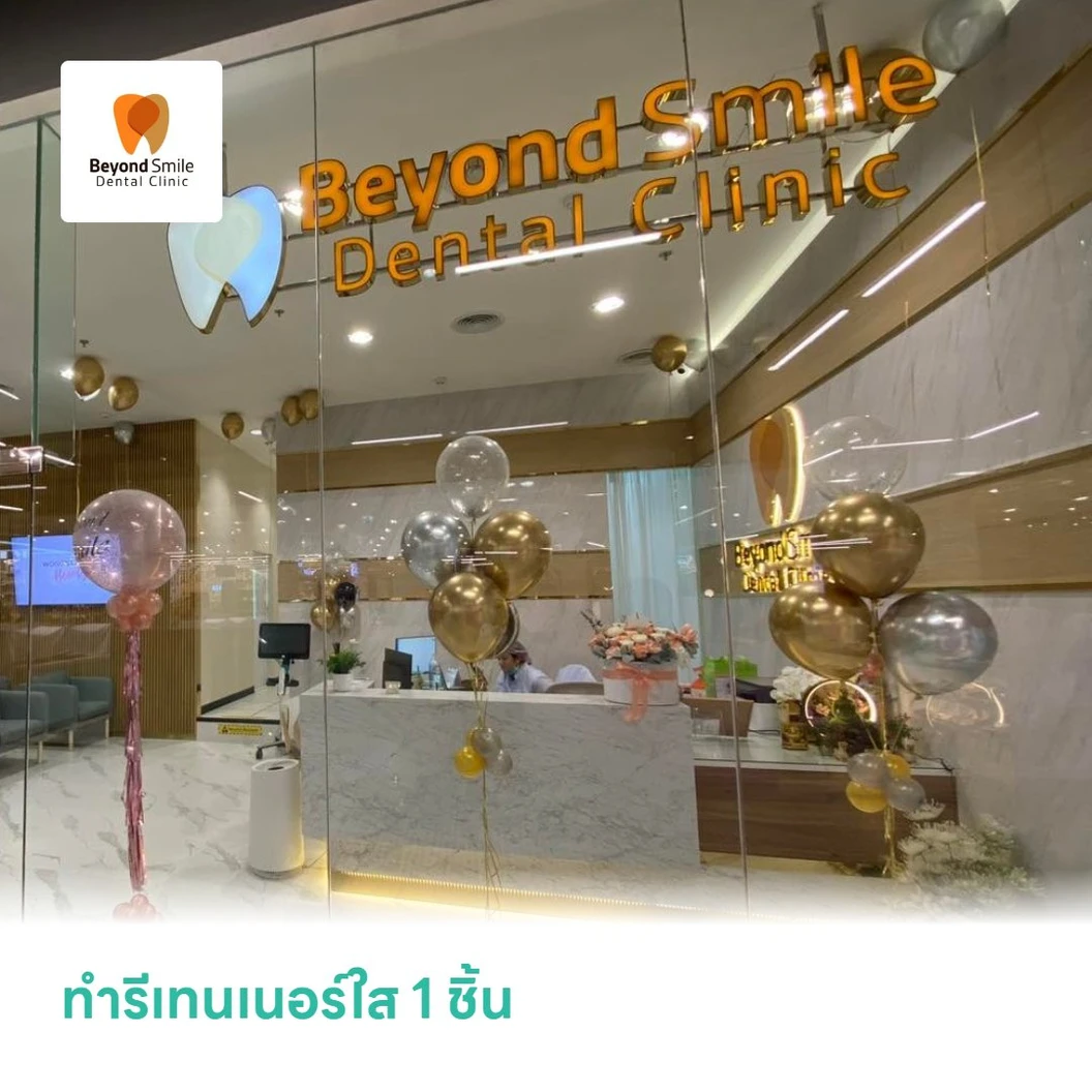 ทำรีเทนเนอร์ใส 1 ชิ้น