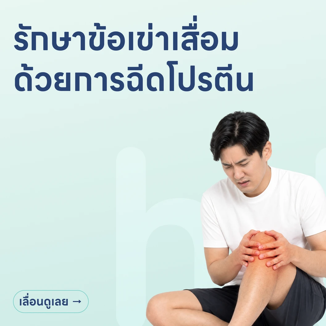 รักษาข้อเข่าเสื่อมด้วยการฉีดโปรตีน