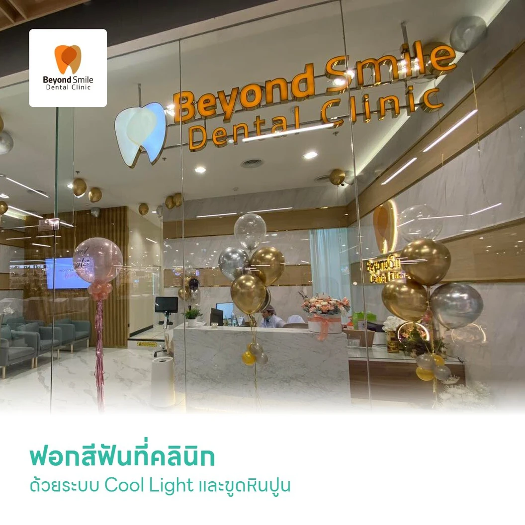 ฟอกสีฟันที่คลินิก ด้วยระบบ Cool Light 2 รอบ 1 ครั้ง และขูดหินปูน 1 ครั้ง