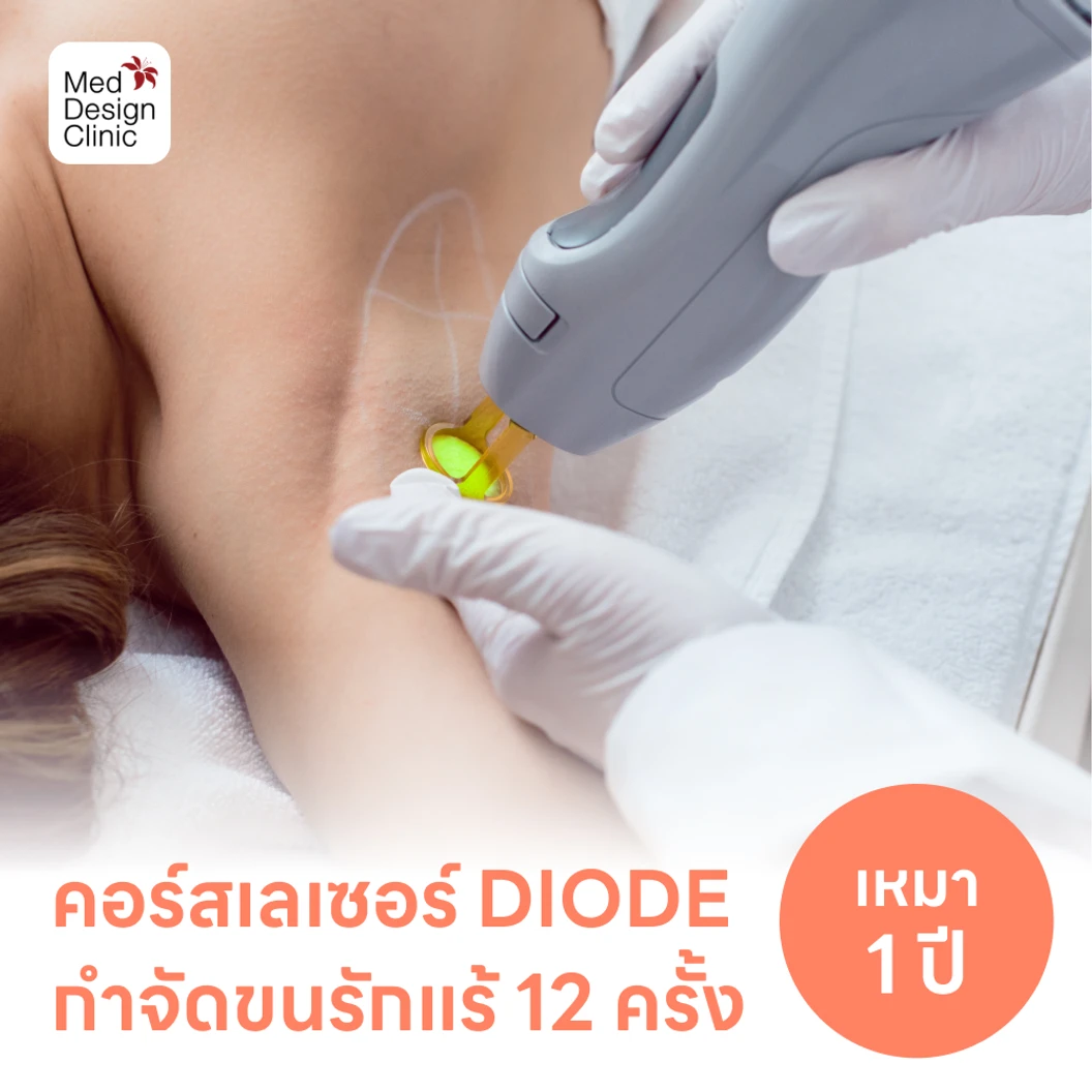 คอร์สเลเซอร์กำจัดขนรักแร้ 12 ครั้ง ด้วย Diode Laser