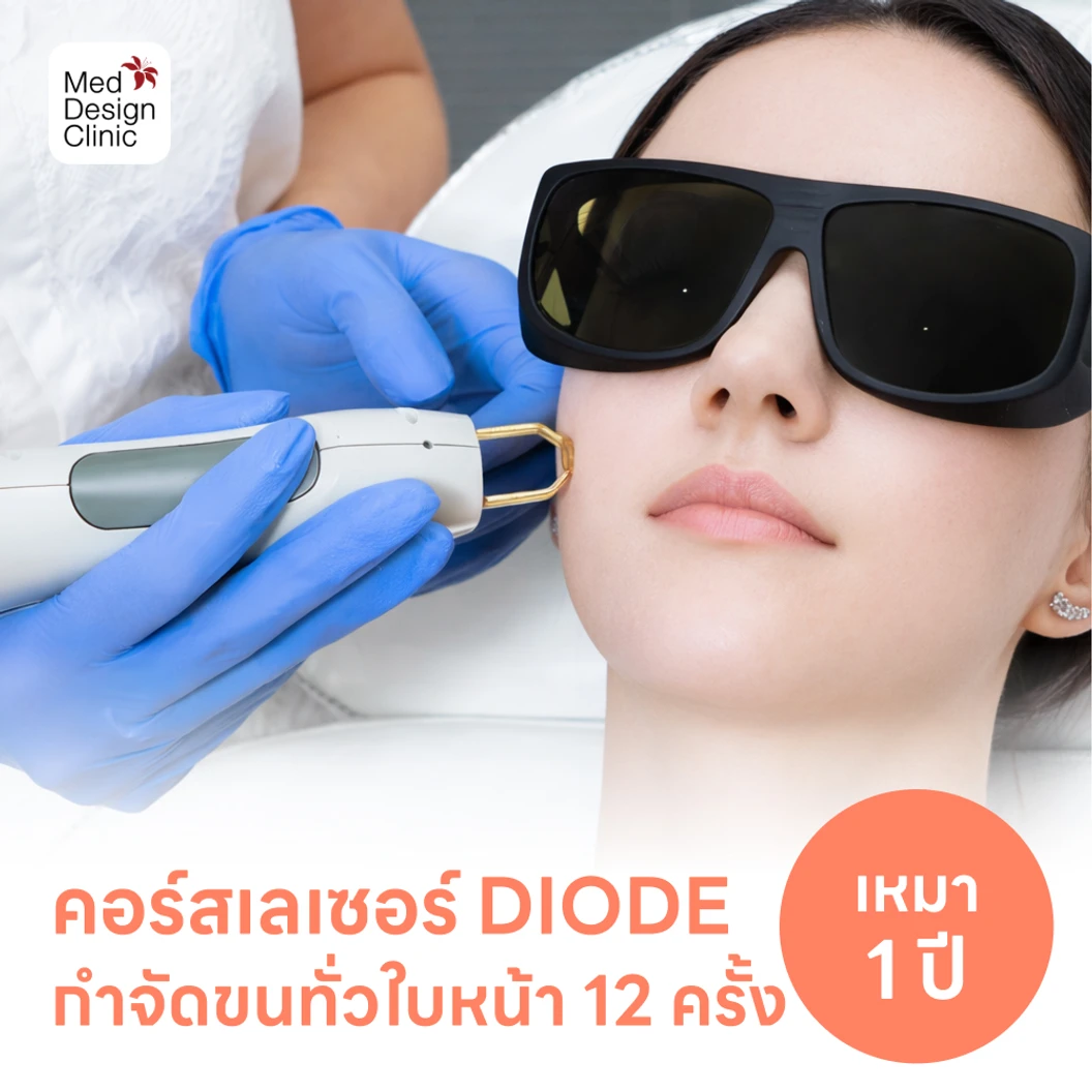 คอร์สเลเซอร์กำจัดขนทั่วหน้า 12 ครั้ง ด้วย Diode Laser