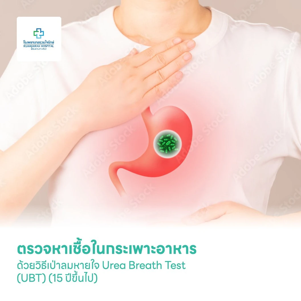 ตรวจหาเชื้อในกระเพาะอาหาร ด้วยวิธีเป่าลมหายใจ Urea Breath Test (UBT) (15 ปีขึ้นไป)
