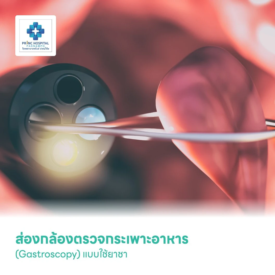 ส่องกล้องตรวจกระเพาะอาหาร (Gastroscopy) แบบใช้ยาชา