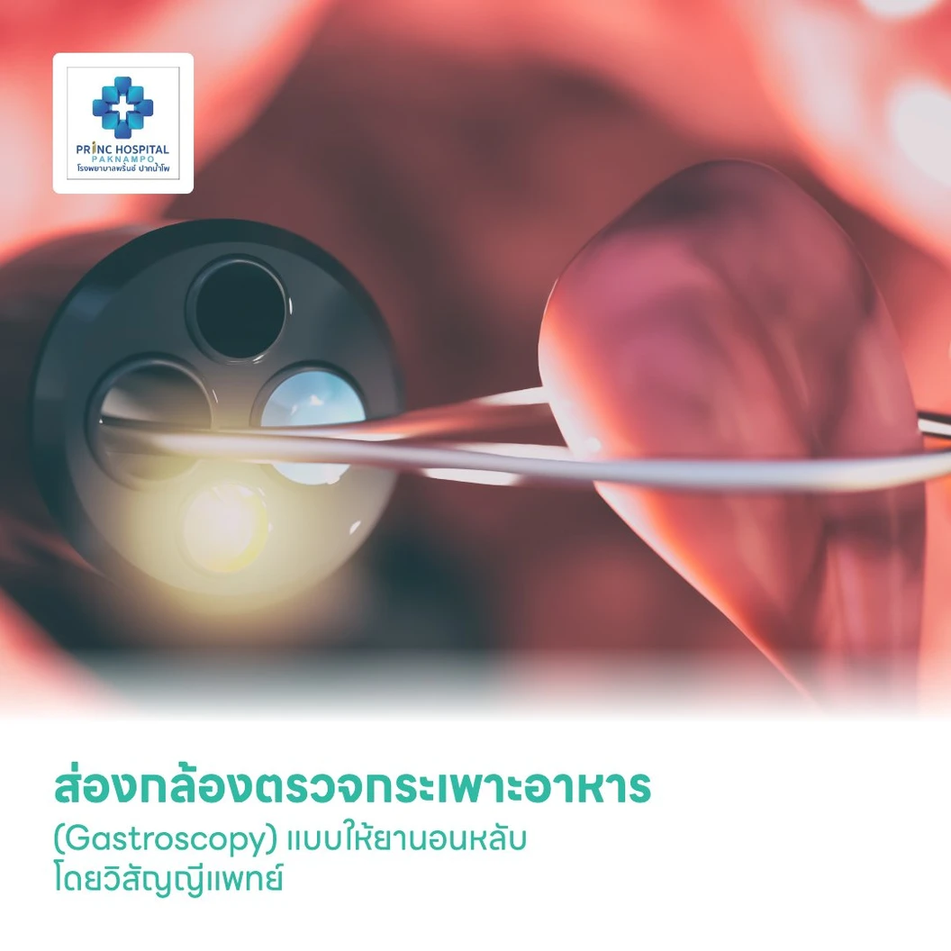 ส่องกล้องตรวจกระเพาะอาหาร (Gastroscopy) แบบให้ยานอนหลับ โดยวิสัญญีแพทย์