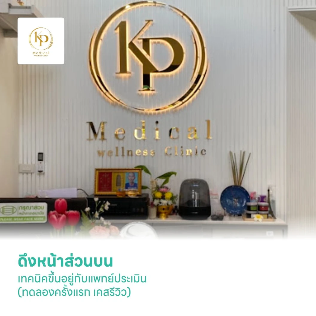 ดึงหน้าส่วนบน (Upper Face Lift Deep Plane) เทคนิคขึ้นอยู่กับแพทย์ประเมิน (ทดลองครั้งแรก เคสรีวิว)