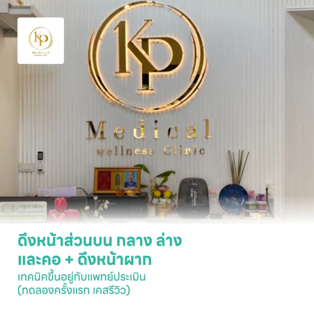 ดึงหน้าส่วนบน กลาง ล่าง และคอ (Full Face Lift and Neck Lift Deep Plane) + ดึงหน้าผาก (Bicoronal Forehead Lift) เทคนิคขึ้นอยู่กับแพทย์ประเมิน (ทดลองครั้งแรก เคสรีวิว)
