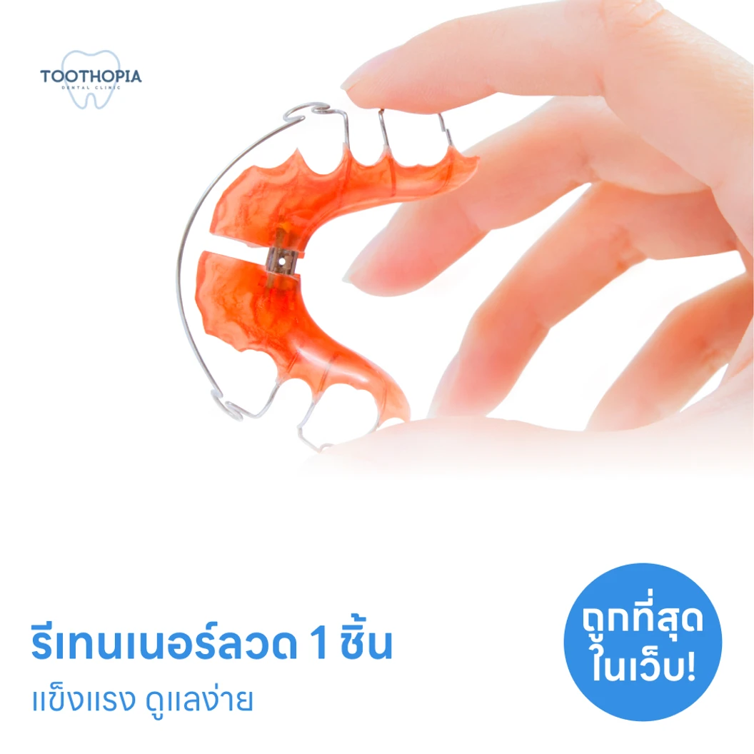 ทำรีเทนเนอร์แบบลวด 1 ชิ้น