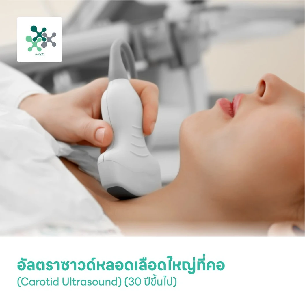 อัลตราซาวด์หลอดเลือดใหญ่ที่คอ (Carotid Ultrasound) (30 ปีขึ้นไป)
