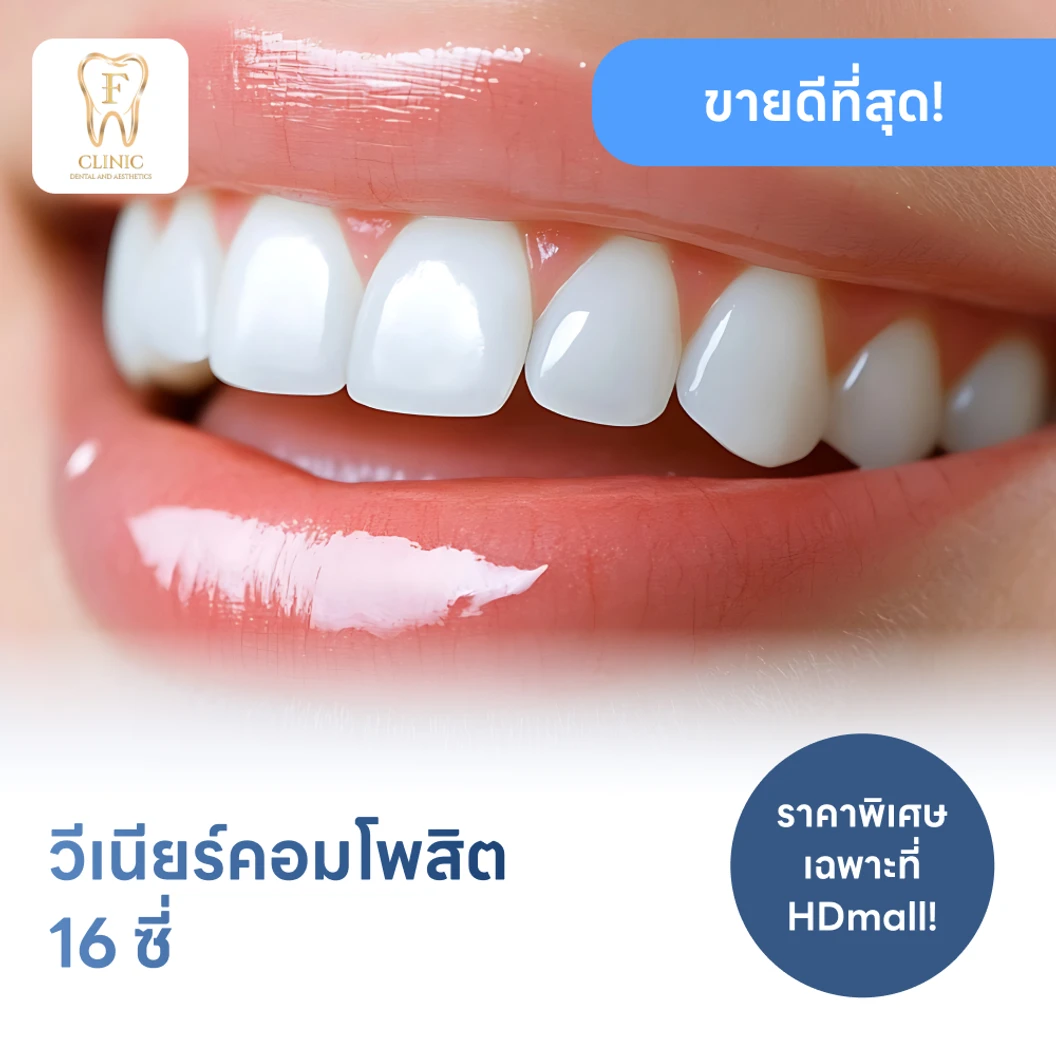 ทำวีเนียร์คอมโพสิต 16 ซี่