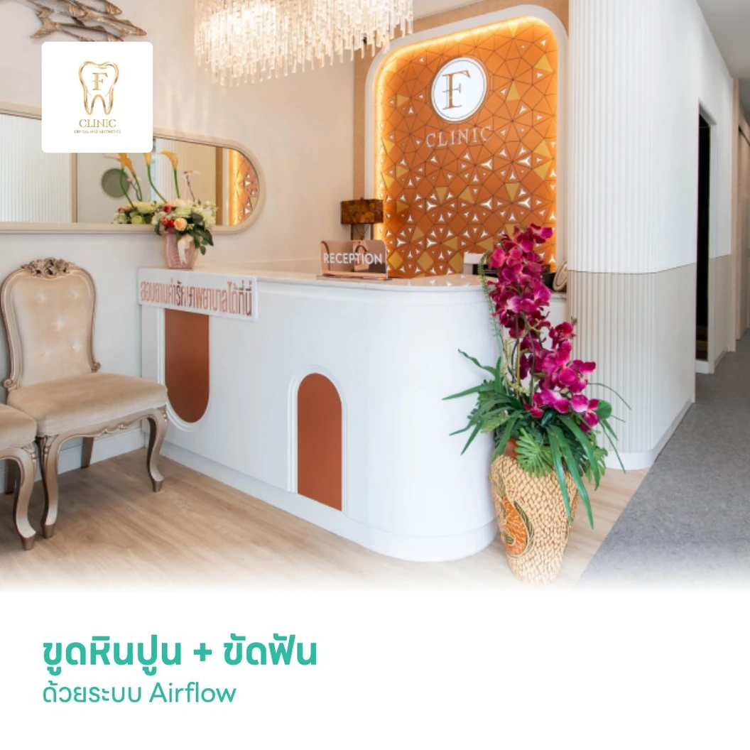 ขูดหินปูน + ขัดฟันด้วยระบบ Airflow