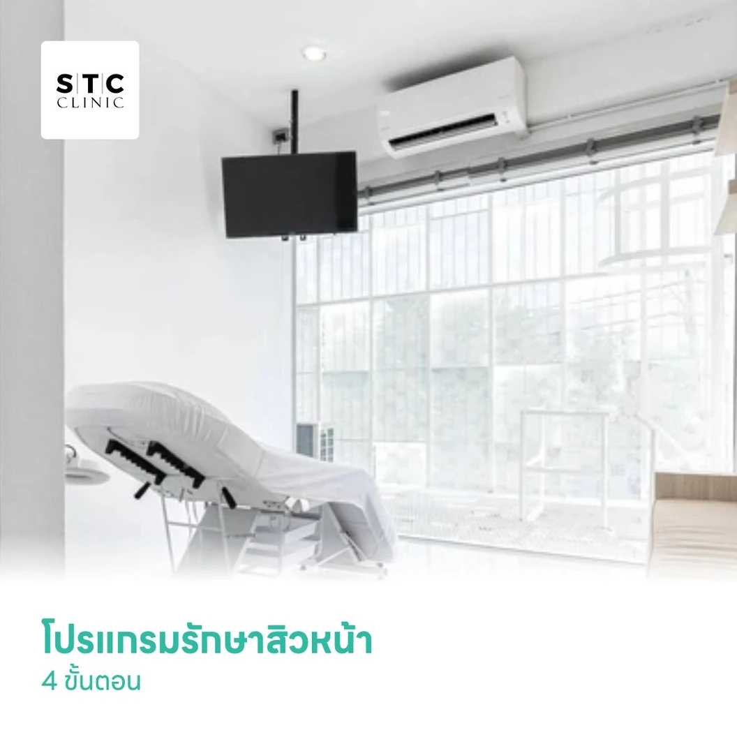 โปรแกรมรักษาสิวหน้า 4 ขั้นตอน