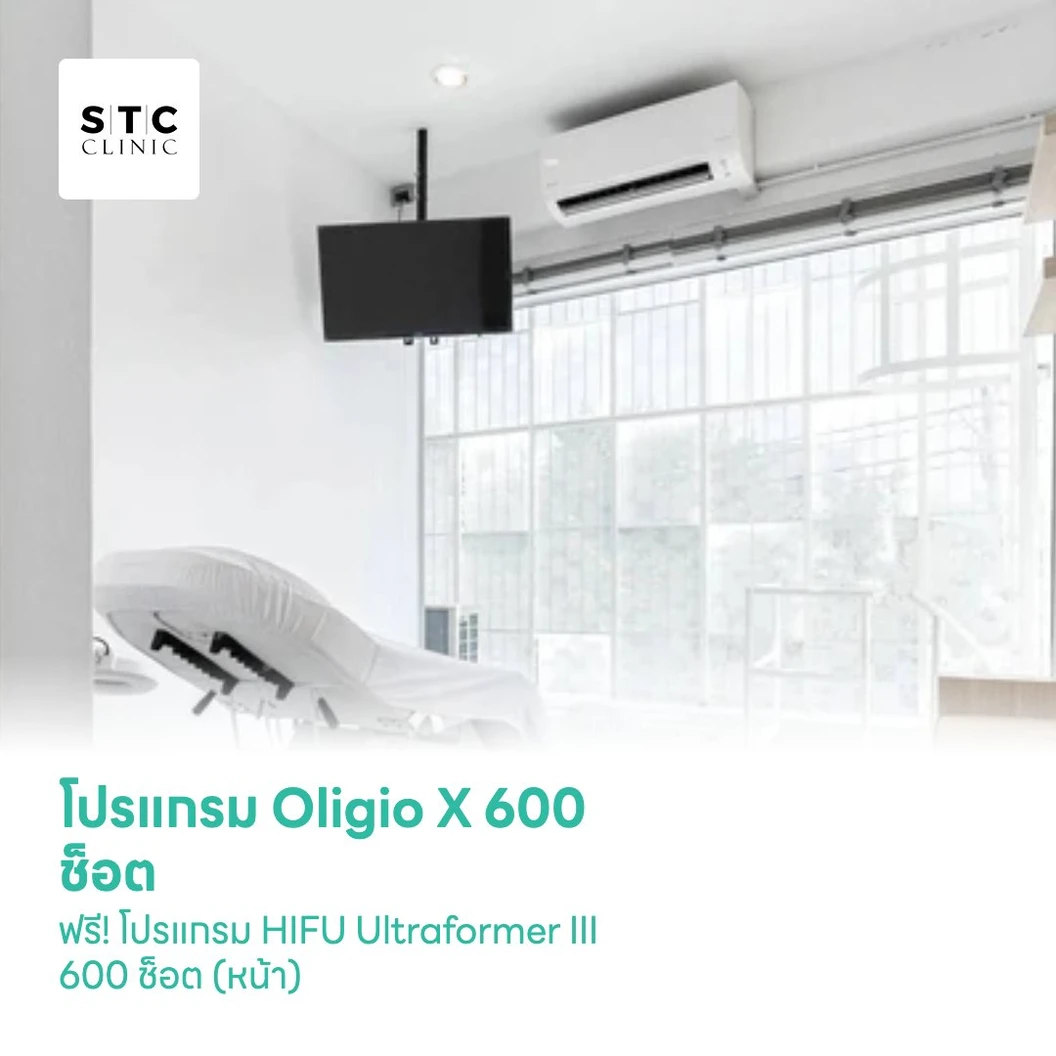 โปรแกรม Oligio X 600 ช็อต (หน้า) ฟรี! โปรแกรม HIFU Ultraformer III 600 ช็อต (หน้า)