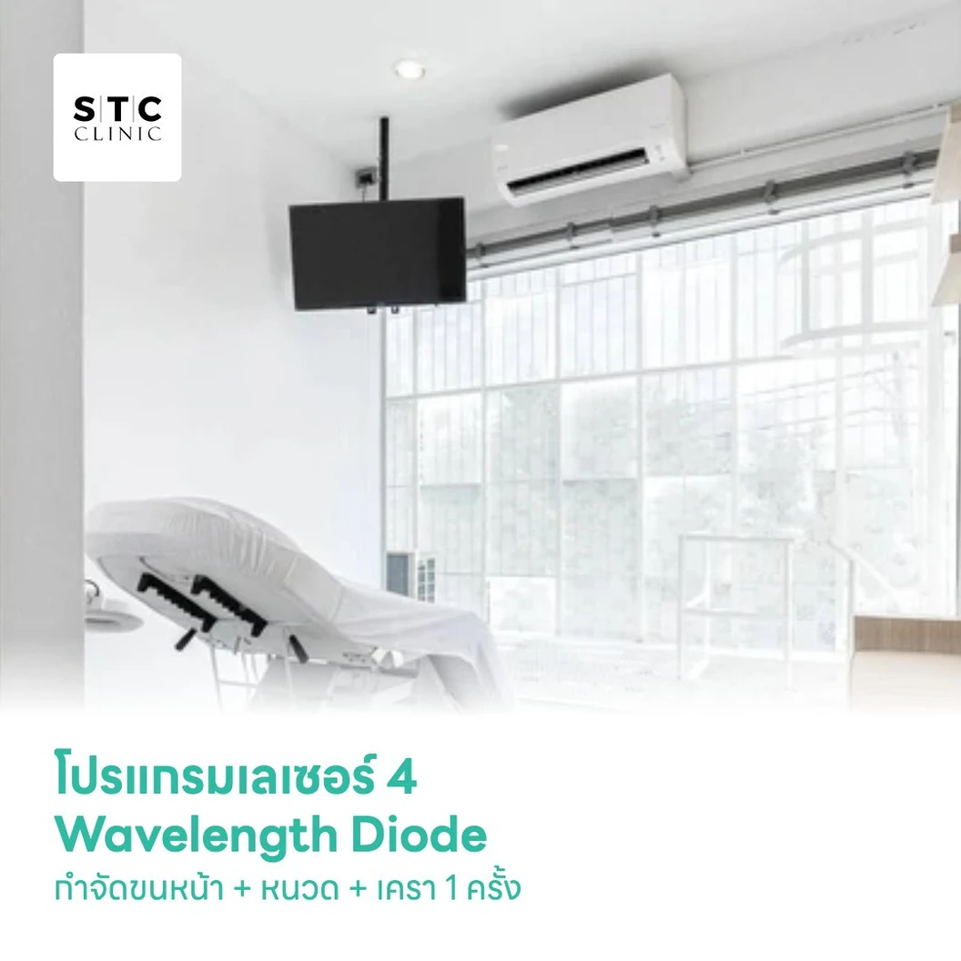 โปรแกรมเลเซอร์ 4 Wavelength Diode กำจัดขนหน้า + หนวด + เครา 1 ครั้ง
