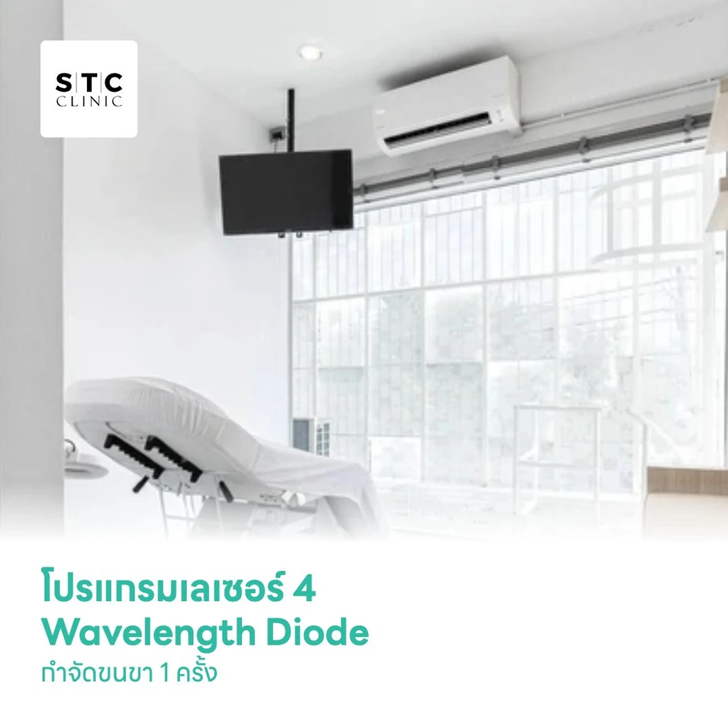 โปรแกรมเลเซอร์ 4 Wavelength Diode กำจัดขนขา 1 ครั้ง
