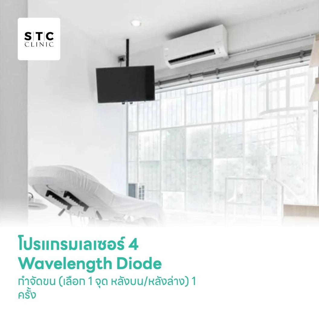 โปรแกรมเลเซอร์ 4 Wavelength Diode กำจัดขน (เลือก 1 จุด หลังบน/หลังล่าง) 1 ครั้ง