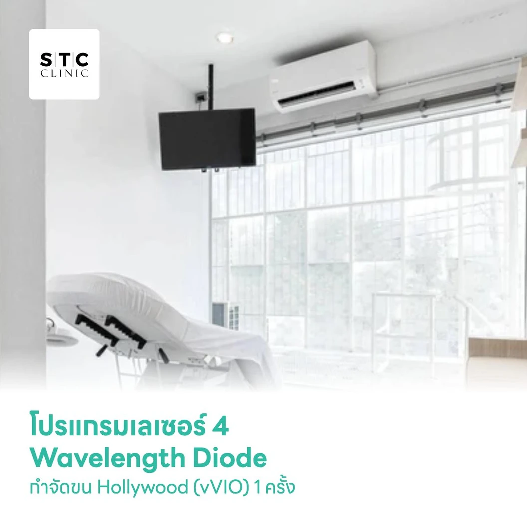 โปรแกรมเลเซอร์ 4 Wavelength Diode กำจัดขน Hollywood (vVIO) 1 ครั้ง