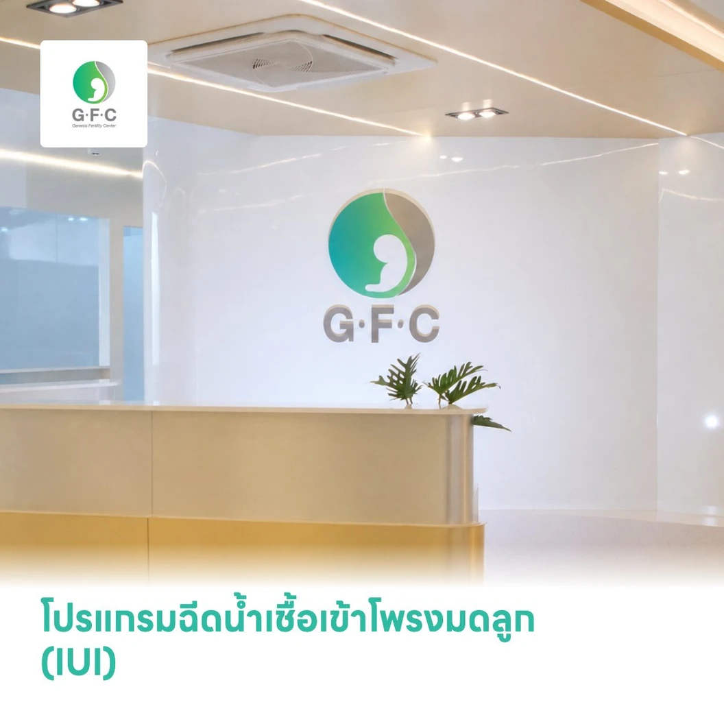 โปรแกรมฉีดน้ำเชื้อเข้าโพรงมดลูก (IUI)